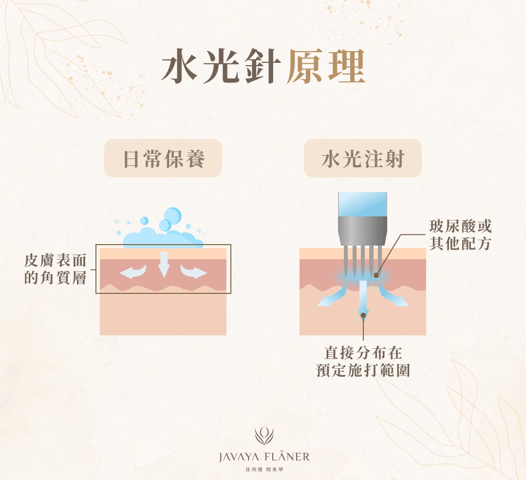 水光針原理