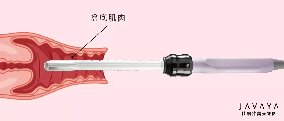 蝴蝶電波是什麼