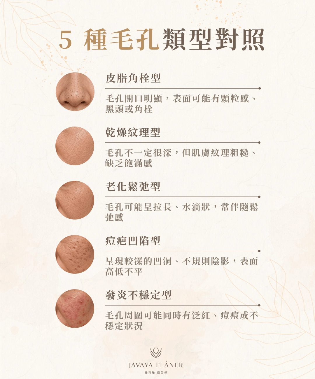 5 種毛孔類型對照